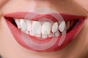 Closeup of smile with white healthy teeth.Teeth whitening. Dental care.