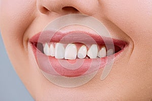 Closeup of smile with white healthy teeth.Teeth whitening. Dental care. Lips care.