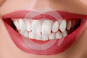 Closeup of smile with white healthy teeth.Teeth whitening. Dental care. Lips care.