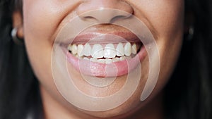 Closeup of smiling ptient showing perfect white teeth with orthodontic invisible braces, teeth whitening treatment or