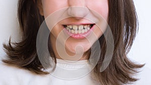 closeup teeth for children dentist and maxillofacial surgeon. clenched teeth