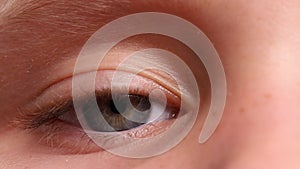 Closeup video shot of child blue eye blinking and looking at camera. Ocular surface disease. Modern surgery for kid eyes