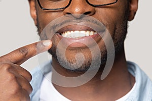 Closeup view african guy pointing finger to white toothy smile