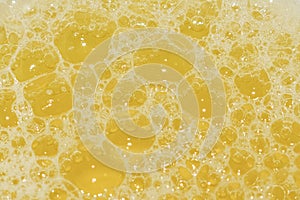 Closeup view of bubbles in frothy urine. Urine sample for urine culture test or examination.