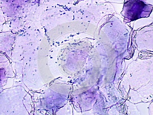 Closeup view of Malassezia yeast in skin crust