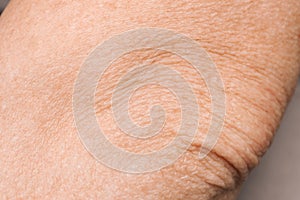Closeup view of mature person with clean skin on elbow