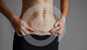 Closeup of woman belly with a scar from a cesarean section