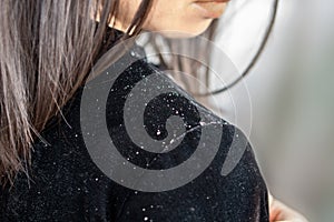 Woman hair having problem with dandruff on shoulder photo