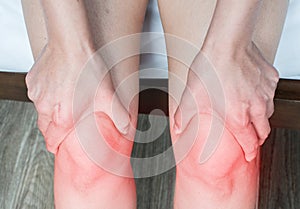 Closeup of woman hands holding and massage her knee, suffering from knee pain.