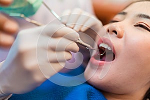 Closeup woman having dental teeth examined dentist check-up via excavator