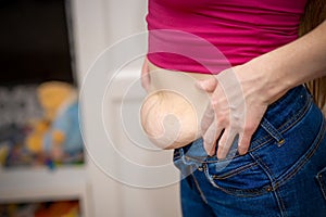 Closeup of woman pinching belly fat.