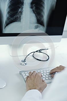 Doctor man ckecking a chest radiograph photo