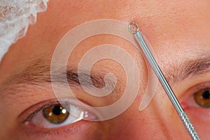 Closeup young mans face preparing for facial cosmetic treatment, doctor using metal tool with loop at end to measure