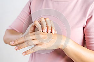 Closeup of young woman scratching the itch on her hands. Health care and medical concept