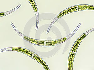 Closterium sp. - Charophyta algae under microscopic view x40, Green algae