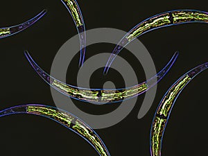 Closterium sp. Charophyta algae under microscopic view x40, Green algae, dark background