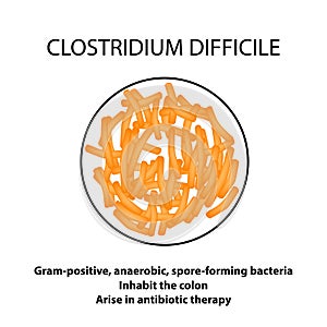 Clostridium difficile. Pathogenic flora. The bacterium causes intestinal diseases. Infographics. Vector illustration. photo