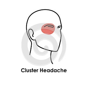 Cluster headache color icon. Vector isolated illustration