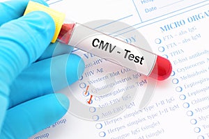 CMV test