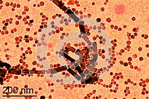 Cobalt nanoparticles