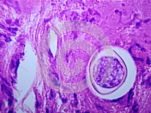 Coccidioides imitis spherule on H and E pathology specimen