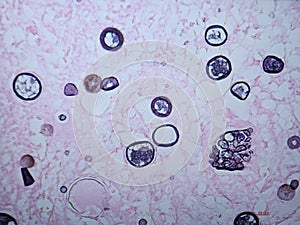 Coccidioides imitis spherules and endospores on GMS stain photo