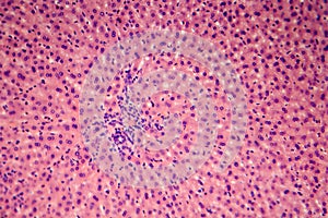 Coccidiosis, coccidia in liver, light micrograph