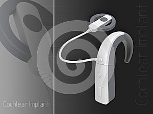 Cochlear Implant