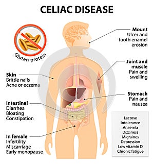 Coeliac disease or celiac disease