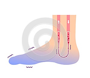 Cold foot blood circulation illustration sensitivity to cold, cold toes / No text