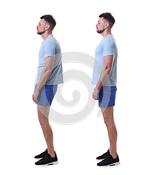 Collage with photos of man with poor and good posture on white background