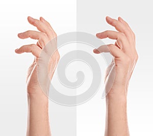 Collage with photos of man showing hands with dry and moisturized skin on white background, closeup