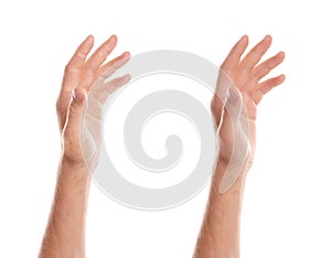 Collage with photos of man showing hands with dry and moisturized skin on white background, closeup