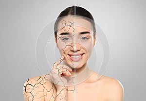 Collage with photos of woman having dry skin problem before and after dry skin problem on light grey background