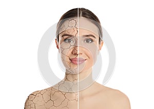 Collage with photos of woman having dry skin problem before and after dry skin problem on white background