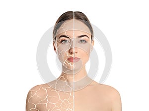 Collage with photos of woman having dry skin problem before and after dry skin problem on white background