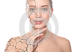 Collage with photos of woman having dry skin problem before and after dry skin problem on white background