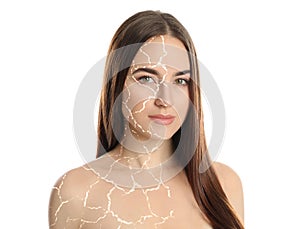 Collage with photos of woman having dry skin problem before and after dry skin problem on white background