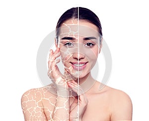 Collage with photos of woman having dry skin problem before and after dry skin problem on white background