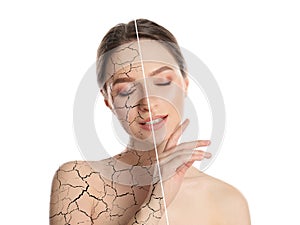 Collage with photos of woman having dry skin problem before and after dry skin problem on white background