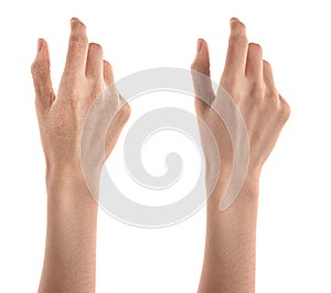 Collage with photos of woman showing hands with dry and moisturized skin on white background, closeup