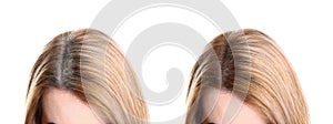 Collage of woman with grey hair before and after coloring on background, closeup. Banner design