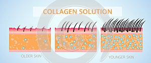 Collagen and Elastin ,Protection Skin and plump.