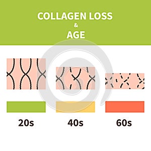 Collagen loss and skin aging cell infographics