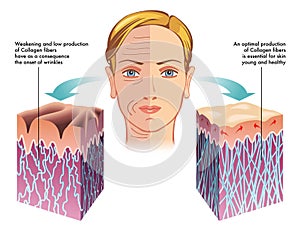 Collagene 