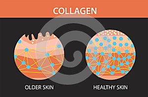 Collagen, older skin and  hearlthy skin ,Protection Skin, vector design