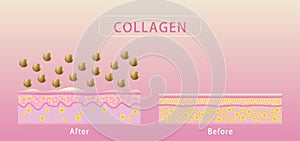 Collagen , Before and after process of getting skin, Protection Skin vector