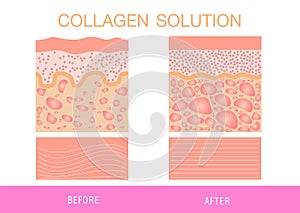Collagen ,Protection Skin vector