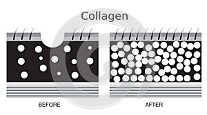Collagen ,skin vector