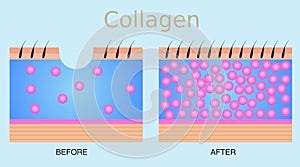 Collagen ,skin vector
